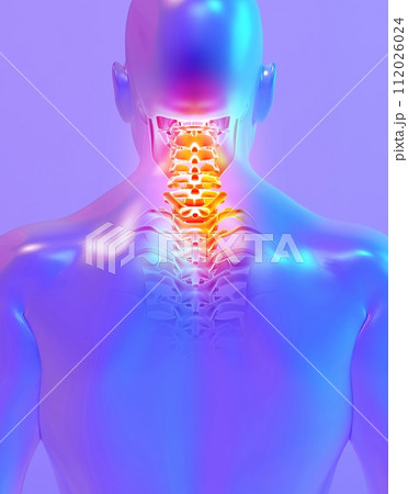 Neck painful skeleton x-ray, 3D illustration. 112026024