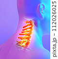 Neck painful skeleton x-ray, 3D illustration. 112026025
