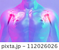 Shoulder painful skeleton x-ray, 3D illustration. 112026026