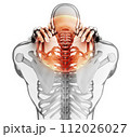 Neck painful - cervical spine skeleton x-ray, 3D illustration. 112026027