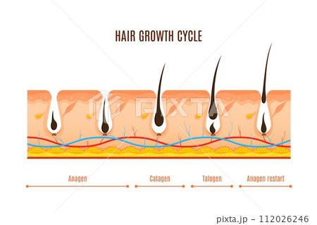 Hair growth cycle phases vector cross section infographics. Anagen, active growth, catagen transitional, telogen resting. Visual representation of hair follicles undergo continuous regeneration stages 112026246