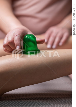 A massage therapist does a lymphatic drainage massage of the calf muscles with a vacuum plastic jar. Vertical photo. A massage therapist does a lymphatic drainage massage of the calf muscles with a vacuum plastic jar. Vertical photo. 112037189