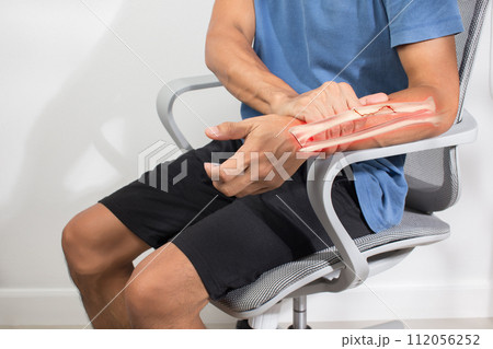 Broken forearm bone 112056252