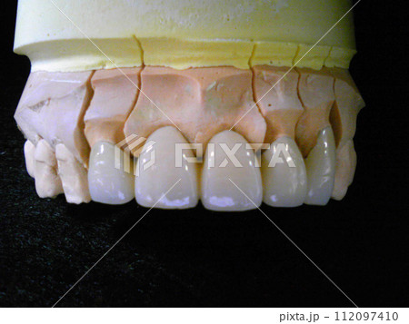 ハイブリッドレジン歯の模型・エステニア前歯 112097410