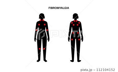 Fibromyalgia medical poster 112104152