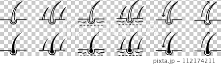 Icon set related to body hair 112174211