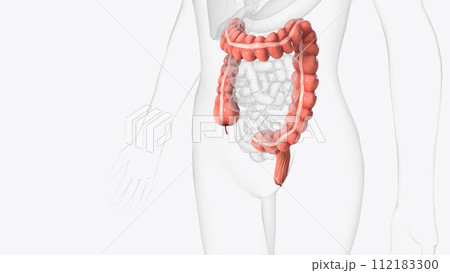 The colon is also known as the large bowel or large intestine 112183300