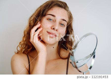 Close-up of a cute woman with problem skin looking in the mirror. Dermatology concept, allergy. Close-up of a cute woman with problem skin looking in the mirror. Dermatology concept, allergy. 112191453