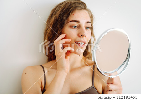 Close-up of a cute woman with problem skin looking in the mirror. Dermatology concept, allergy. Close-up of a cute woman with problem skin looking in the mirror. Dermatology concept, allergy. 112191455