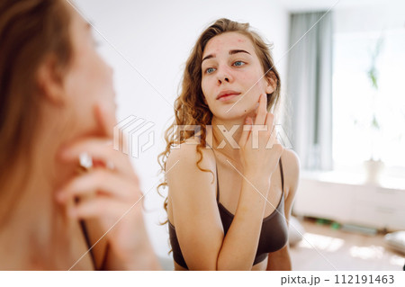 Close-up of a young woman looking at pimples in the mirror. Red spots, rash, acne. Skin treatment. Close-up of a young woman looking at pimples in the mirror. Red spots, rash, acne. Skin treatment. 112191463