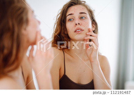 Close-up of a young woman looking at pimples in the mirror. Red spots, rash, acne. Skin treatment. 112191487