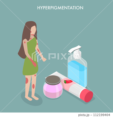 3D Isometric Flat Vector Illustration of Hyperpigmentation 112199404