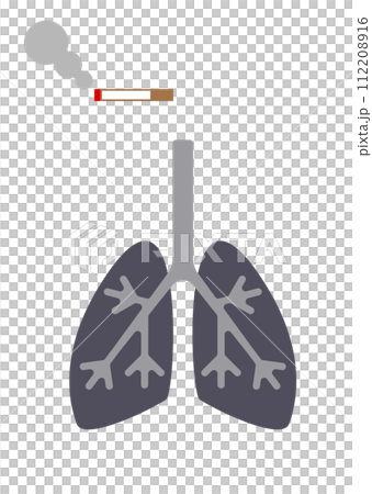 Illustration of a smoker's lungs 112208916