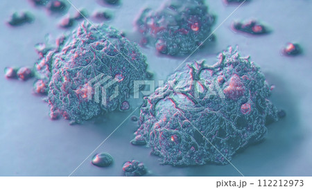 Cancer cells. Growth of a tumor, 3D illustration Cancer cells. Growth of a tumor, 3D illustration 112212973