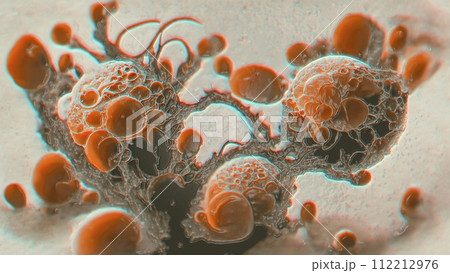 Cancer cells. Growth of a tumor, 3D illustration Cancer cells. Growth of a tumor, 3D illustration 112212976