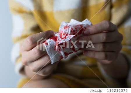 出血した膝の手当てをする女性(顔なし) 出血した膝の手当てをする女性(顔なし) 112213072