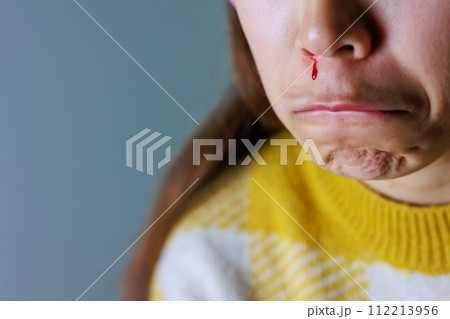 鼻から血が流れる女性の口元(パーツカット) 鼻から血が流れる女性の口元(パーツカット) 112213956