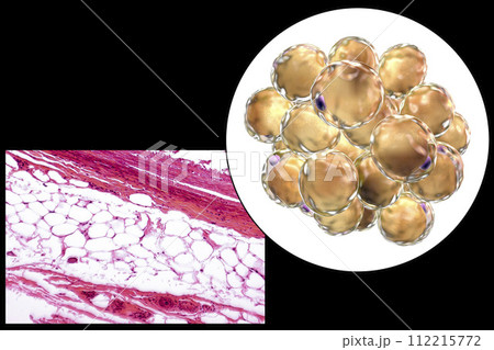 Fat cells, micrograph and 3D illustration 112215772