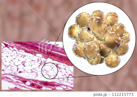 Fat cells, micrograph and 3D illustration 112215773