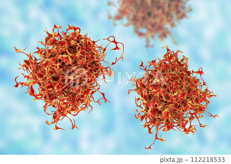 Cancer cell, malignant tumor cell 112218533
