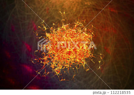 Cancer cell, malignant tumor cell 112218535