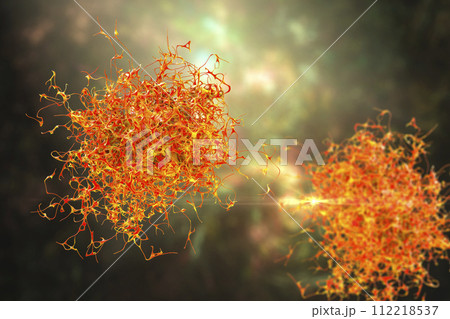 Cancer cell, malignant tumor cell 112218537