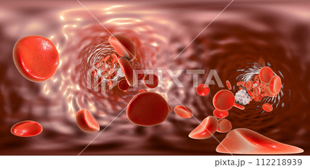 Panorama view inside blood vessel 112218939