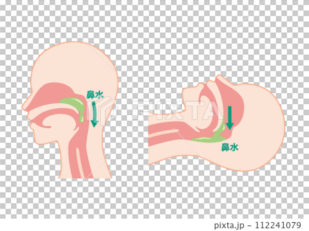 postnasal drip 112241079