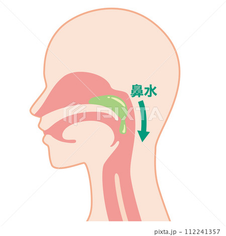 後鼻漏 112241357