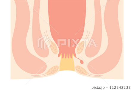 人体　直腸・肛門周辺　図解イラスト、断面図 112242232