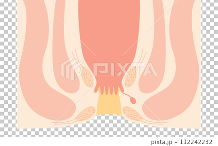 人体　直腸・肛門周辺　図解イラスト、断面図 112242232