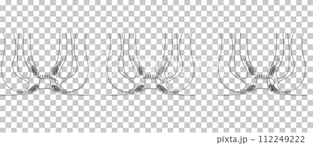 肛門疾病,痔瘡「肛門痔瘡」插圖,橫斷面圖 肛門疾病,痔瘡「肛門痔瘡」插圖,橫斷面圖 112249222