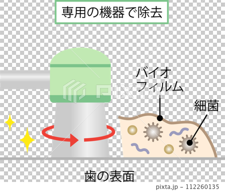 歯のバイオフィルム除去 112260135