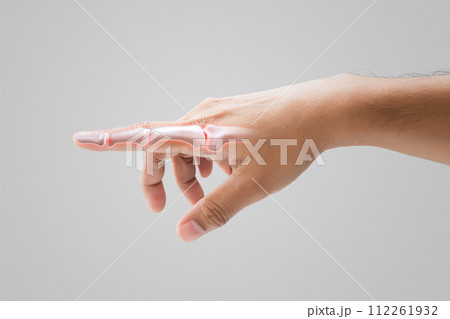 Inflammation of forefinger bone Inflammation of forefinger bone 112261932