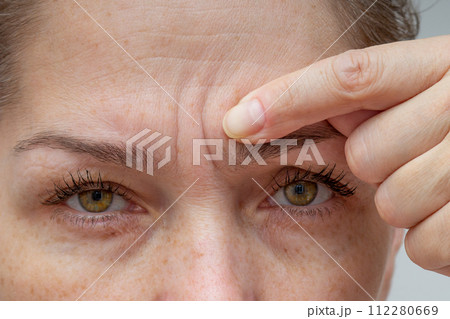 Cropped woman face pointing at wrinkles between eyebrows by finger 112280669