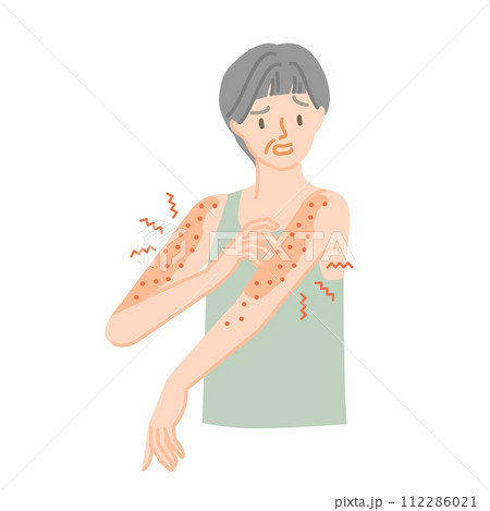 皮膚の病気:腕がかゆくてイライラするシニア女性 皮膚の病気:腕がかゆくてイライラするシニア女性 112286021
