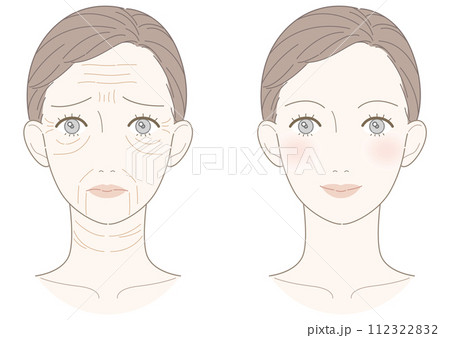 しわ 改善 女性 イラスト しわ 改善 女性 イラスト 112322832