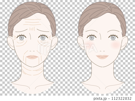 Wrinkle improvement woman illustration 112322832