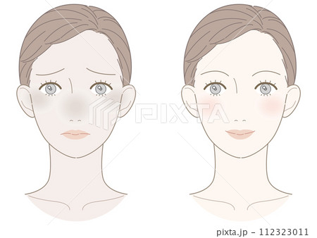 くすみ　改善　女性　イラスト 112323011