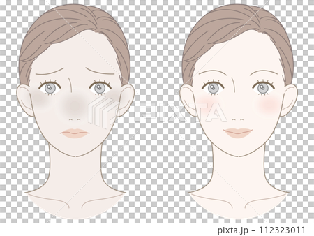 くすみ　改善　女性　イラスト 112323011
