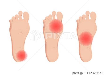 Foot pain, leg injury vector illustration design. Chronic rheumatology and inflammation. Foot pain, leg injury vector illustration design. Chronic rheumatology and inflammation. 112329549