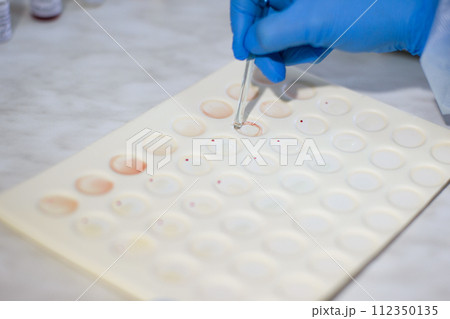 Blood test 112350135