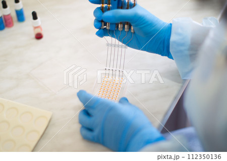 Examination of blood samples with a special syringe in the laboratory 112350136