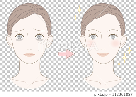 くま　女性　ビフォーアフター　イラスト 112361857