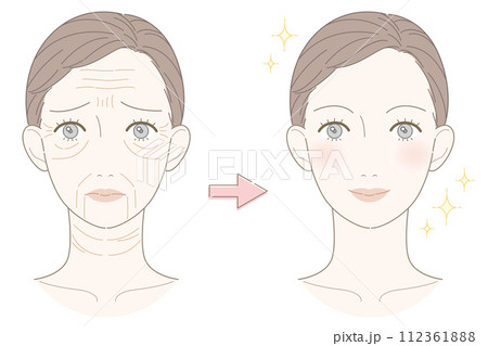 しわ 女性 ビフォーアフター イラスト しわ 女性 ビフォーアフター イラスト 112361888