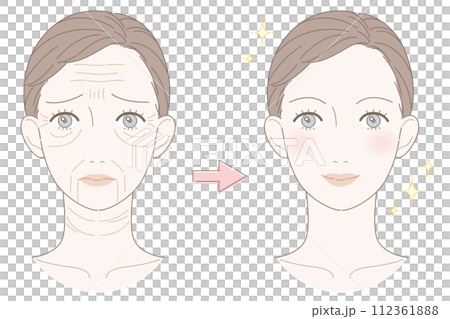 Wrinkled woman before and after illustration 112361888