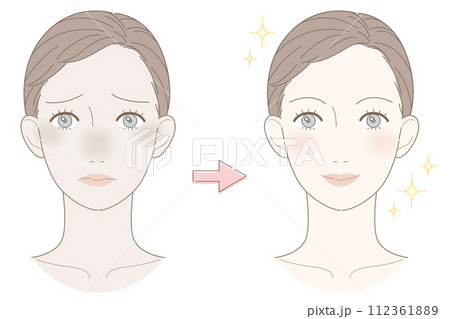 くすみ 女性 ビフォーアフター イラスト くすみ 女性 ビフォーアフター イラスト 112361889
