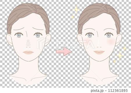 草莓鼻女人前後插畫 112361893