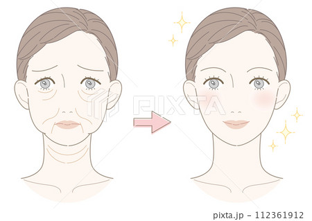 たるみ 女性 ビフォーアフター イラスト たるみ 女性 ビフォーアフター イラスト 112361912