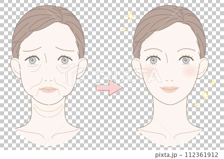 たるみ 女性 ビフォーアフター イラスト たるみ 女性 ビフォーアフター イラスト 112361912